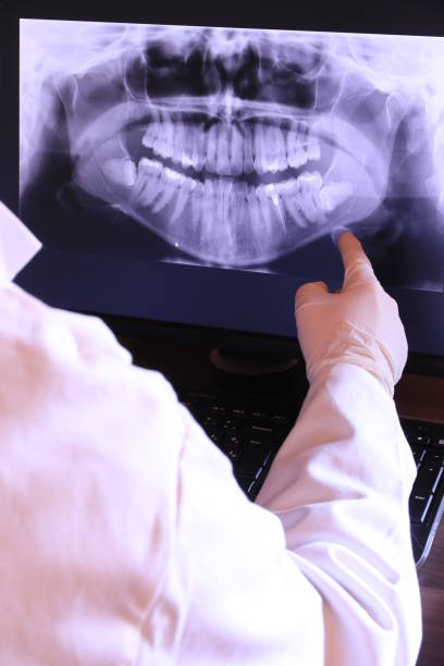 Best Urgent Care for Lost Fillings or Crowns in Pughtown, PA