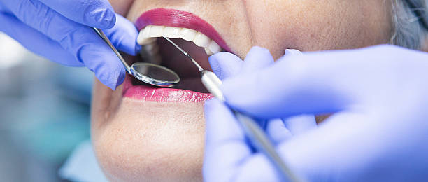 Best Emergency Dental Care for Broken or Chipped Teeth in Pughtown, PA